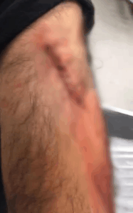 Şanlıurfa’da Öğretmene Jiletli Saldırı!