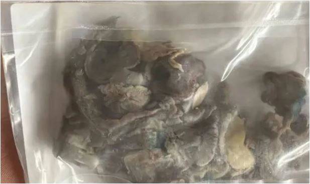 Genç Elektronik Sigara Kurbanı Oldu!