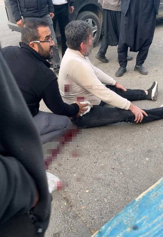 Şanlıurfa'da Bıçaklı Kavga! Bir Yaralı...