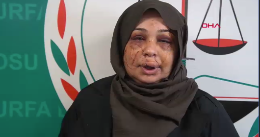 Polis Eşi Tarafından Darp Edildi, Şanlıurfa’ya Sığındı