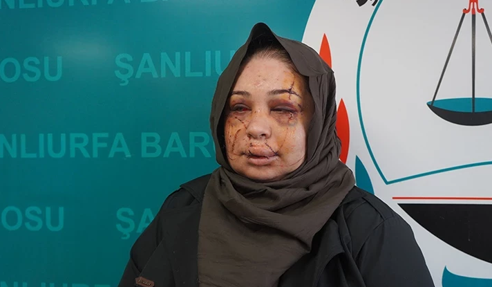 Şanlıurfa Valiliği: Hemşerimiz İçin Tüm Destekler Sağlanmıştır