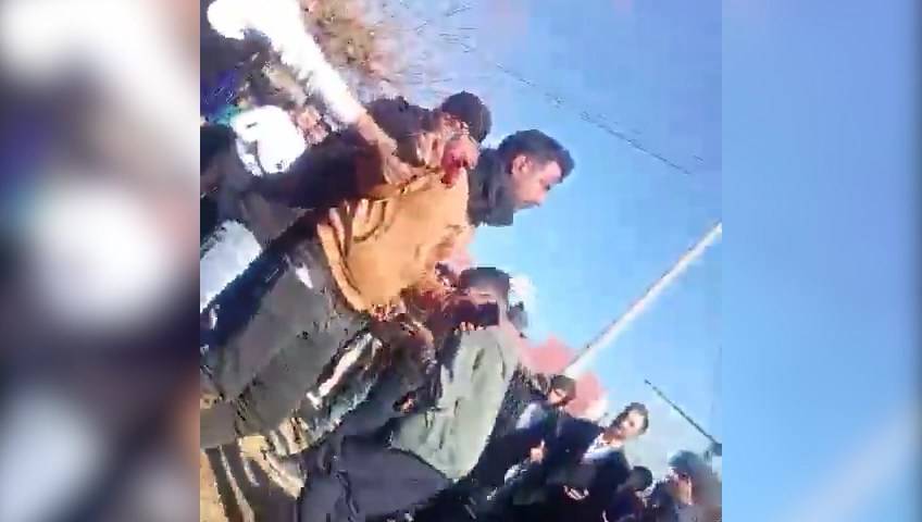 Şanlıurfa'da Maganda Kurşunu Davulcuyu Yaraladı