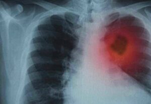 Urfa'da 30 yıllık bağımlılığından ücretsiz kurtuldu!