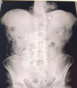 Uşak'ta zehir tacirlerine operasyon